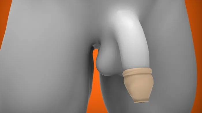 Oxballs Anal Oxballs Bell Moreskin Foreskin Set